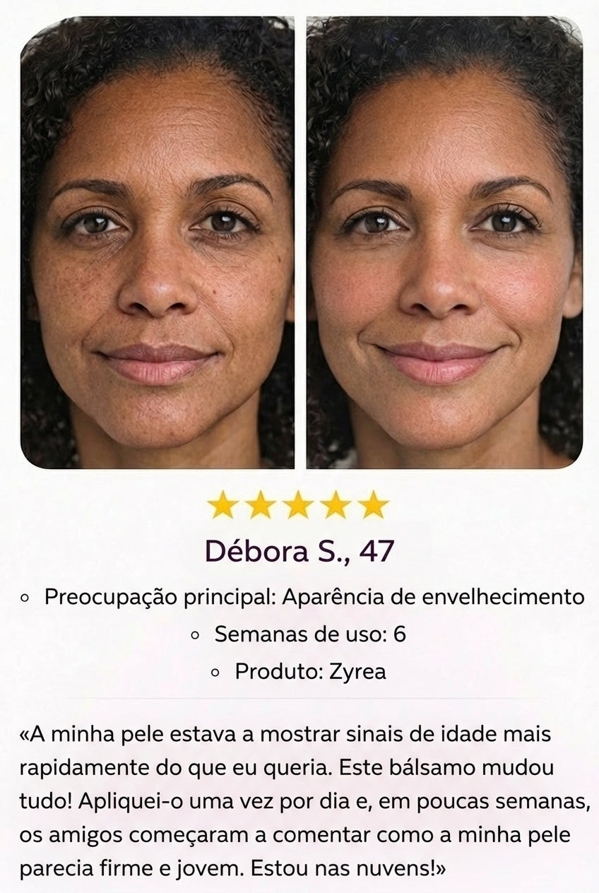 Zyrea® Cemenrete Calcium Intense Cream